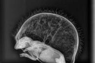 xray van ballon egel